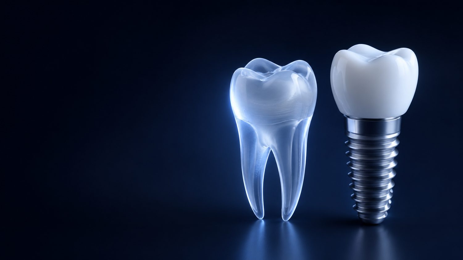 Dental implants with Dr. Vik