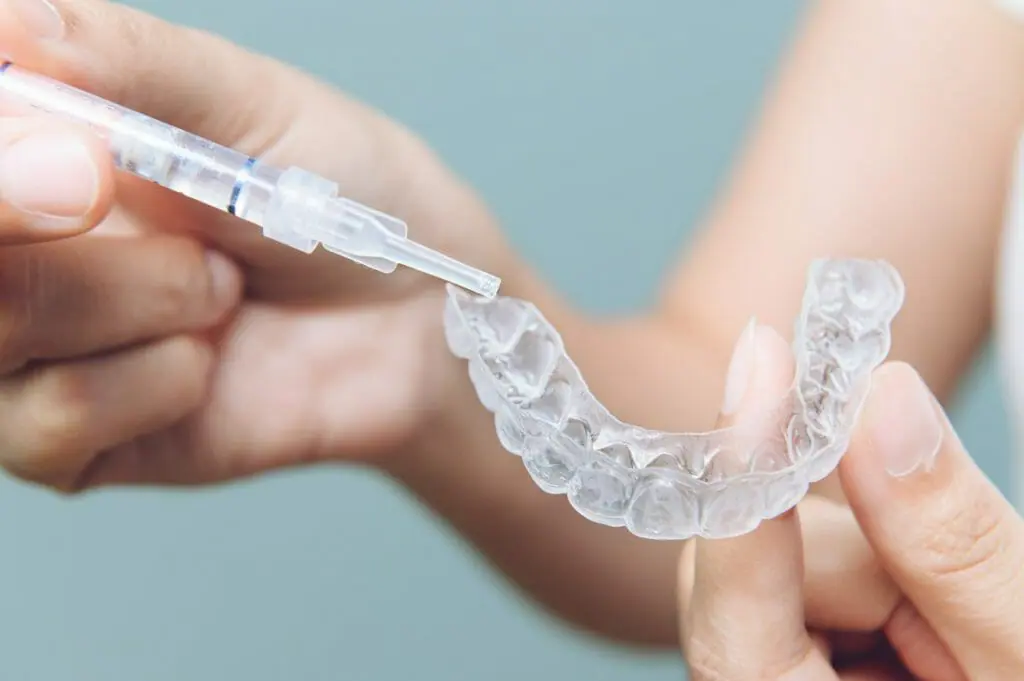 Whitening in a smile makeover